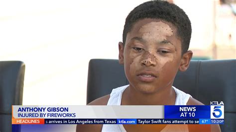12-year-old boy's hand ruptured by illegal firecracker in South L.A.